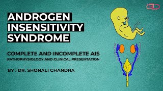 Androgen Insensitivity Syndrome  Pathophysiology amp Clinical Presentation Complete amp Incomplete AIS [upl. by Aisiram]