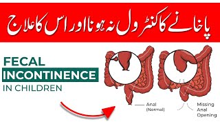 Fecal Incontinence in Children  Its Symptoms Causes and Treatment by Dr Umar Nisar [upl. by Banerjee129]