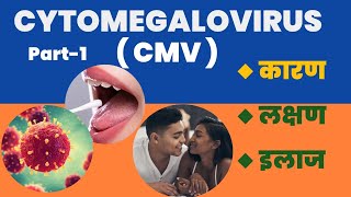 Cytomegalovirus  CMV  Positive l कारण । लक्षण । और इलाज l Part1 [upl. by Nennek]