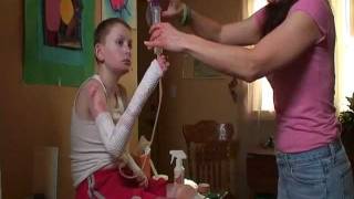 EJ had Epidermolysis Bullosa EB  quotThe Worst Disease Youve Never Heard Ofquot [upl. by Llehcram]