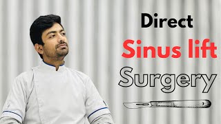 Direct Sinus Lift and Placement of Implant Dental Implants Sinus lift  Dr Sunil Kumar [upl. by Ardin]