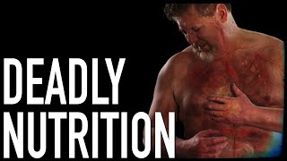 Deadly Nutrition The REAL Dietary Killers  Dr Michael Greger [upl. by Tham472]