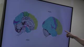 SOLMS Neuropsychoanalysis WMC Grand Rounds Dec 2017 Part I [upl. by Yluj]