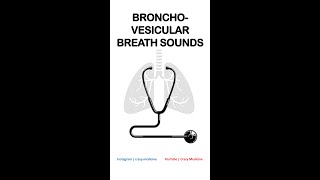 Bronchovesicular Breath Sounds [upl. by Eseenaj]