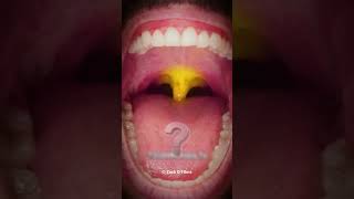 Your Oral Health Affects Your Entire Body Mouth Bell [upl. by Atinal]