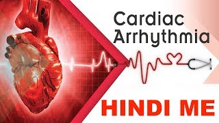 What is Arrhythmias  Tachycardia VS Bradycardia in Hindi  Medical Guruji [upl. by Teillo]