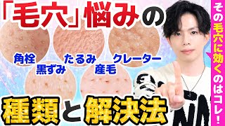 【あなたの毛穴悩みはどのタイプ？】毛穴悩みの種類と解決法！効くスキンケア＆美容医療を解説！【角栓・黒ずみ・たるみ・クレーター・産毛】 [upl. by Fadiman563]