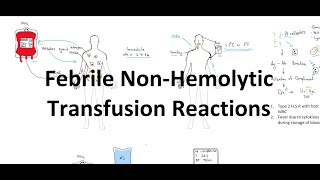 Febrile Non Hemolytic Transfusion Reaction [upl. by Notelrac]