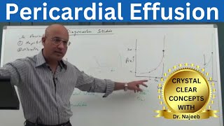 Pericardial Effusion  Pericardium  Cardiology🫀 [upl. by Cottrell]