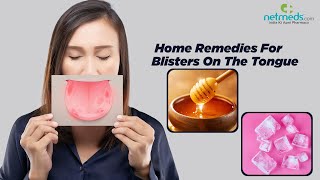 Blisters On The Tongue 6 Effective Home Remedies [upl. by Saire]