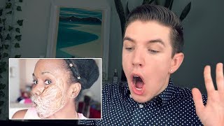 Specialist Reacts to DIY Chemical Peels [upl. by Rist]