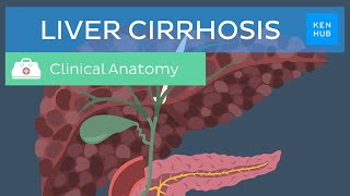 Liver cirrhosis Definition pathology diagnosis treatment and prevention  Kenhub [upl. by Donnell]