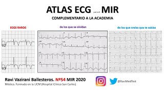 Atlas de ECG avanzado para cardiología en el examen MIR [upl. by Nahtan]