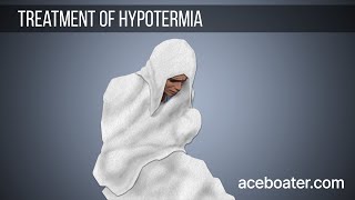 Treatment of Hypothermia [upl. by Trip]