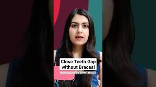 Close Front Teeth Gaps Without Braces Dr Srishti Bhatia gapaligner teeth smile [upl. by Anaz]