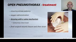 TRAUMA PATIENT  Flail chest pneumothorax [upl. by Charlean]