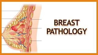 Breast Pathology Inflammatory vs Benign vs Malignant [upl. by Berty504]