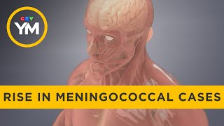 Health units report rise in meningococcal cases  Your Morning [upl. by Cousins982]