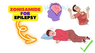 Zonisamide Review Understanding the Benefits and Potential Side Effects in Epilepsy Management [upl. by Oirasec]