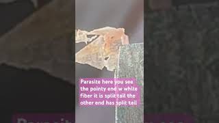 fungus spore mold skin flukes morgellons myjourney skin condition ulcer help share win [upl. by Eleinad]