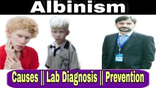 Albinism  Causes  Lab diagnosis  Prevention [upl. by Tegan]