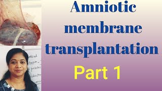 Amniotic membrane transplantation in ophthalmology Layers source Ocular surface disorders [upl. by Lesde912]