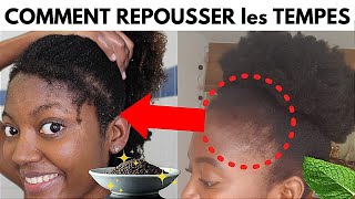 COMMENT j ai fait REPOUSSER MES CHEVEUX des TEMPES RAPIDEMENT100 NATUREL et MOINS CHER [upl. by Anayhd]