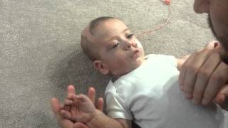 Baby Zacchaio 6 months old Complex Partial Seizure [upl. by Nele]