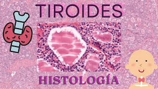 Histología de Tiroides [upl. by Peterus]