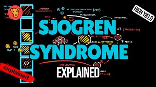 Sjogren syndrome Pathogenesis EULAR Guideline Diagnostic Criterias Treatment Explained [upl. by Nylorak925]