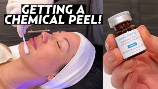 I Got a Chemical Peel My Experience With SkinCeuticals TCA Peel for Hyperpigmentation amp Melasma [upl. by Anomis984]