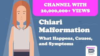 Chiari Malformation  What Happens Causes and Symptoms [upl. by Hardin]