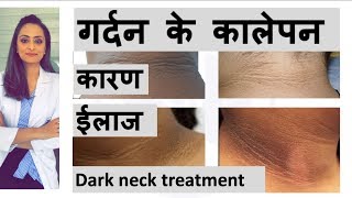 Dark neck  causes  Treatment  home remedy गर्दन के कालेपन  Dermatologist  Dr Aanchal Panth [upl. by Norah642]