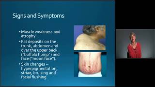 MedicalSurgical Nursing Exam Review Endocrine Disorders  MEDED [upl. by Schroder]