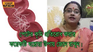 পেটের কৃমি প্রতিরোধ করার কয়েকটি ঘরোয়া উপায় জেনে রাখুন।  EP 152 [upl. by Rramal354]