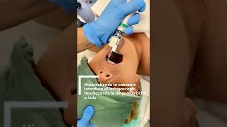 LARINGOSCOPIA DIRECTA e intubación endotraqueal anestesia medicina laringoscopia tutorial [upl. by Ditzel177]