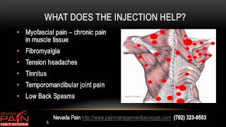 Trigger Point Injections explained by a Las Vegas pain management center [upl. by Acnayb]