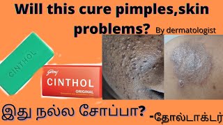 originalold cinthol soap review by dermatologistwill it cure pimples skin problems [upl. by Thay]