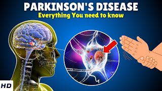 Parkinson’s Disease – Causes Signs and Symptoms Diagnosis amp Treatment [upl. by Neerbas]