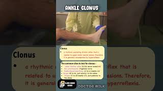 Ankle clonus neetpg usmle [upl. by Leimad]