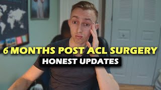 6 Months Post ACL Surgery  Honest Updates [upl. by Glass47]