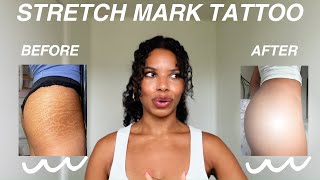 STRETCH MARK TATTOO BEFORE amp AFTER [upl. by Nosral347]