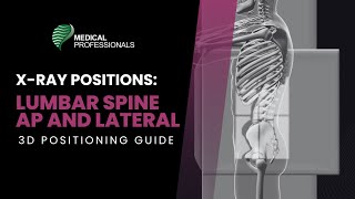 Radiographic Positioning Lumbar Spine AP and Lateral [upl. by Ut]