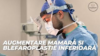 Operația de augmentare mamară și blefaroplastie superioarăBreast Augmentation Lower Blepharoplasty [upl. by Nowyt]