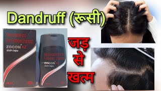 Zocon KZ shampoo uses  Ketoconazole shampoo use in hind  Dandruff treatment in hindi रूसी से राहत [upl. by Yeldah]