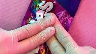 Surgery on a Skittles Pack comedy funny [upl. by Jeffers727]