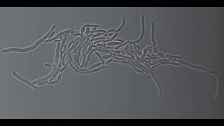 Multiple fission in Corynebacterium matruchotii [upl. by Hildegaard]