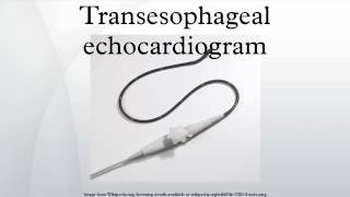 Transesophageal echocardiogram [upl. by Eedolem]