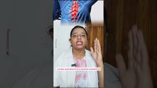 Lumbar spondylosis BaksonHomoeopathy homoeopathy drkuralkallazhagar [upl. by Artsa]