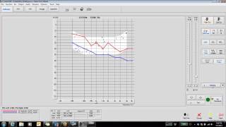 Customize Your MedRx A2D Software [upl. by Nnylidnarb805]